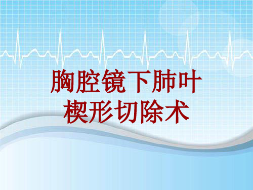 手术讲解模板：胸腔镜下肺叶楔形切除术