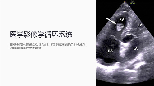 医学影像学循环系统