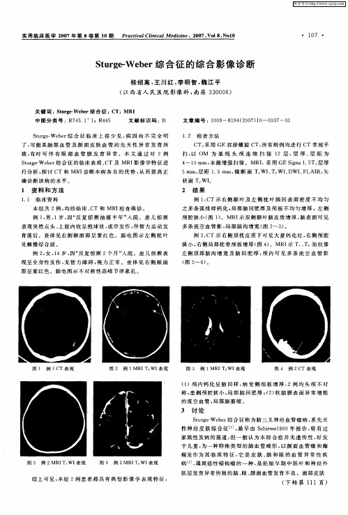 Sturge-Weber综合征的综合影像诊断