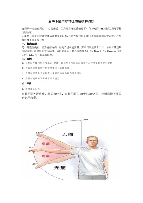 肩峰下撞击综合征的症状和治疗