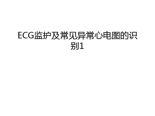 ECG监护及常见异常心电图的识别1讲解学习