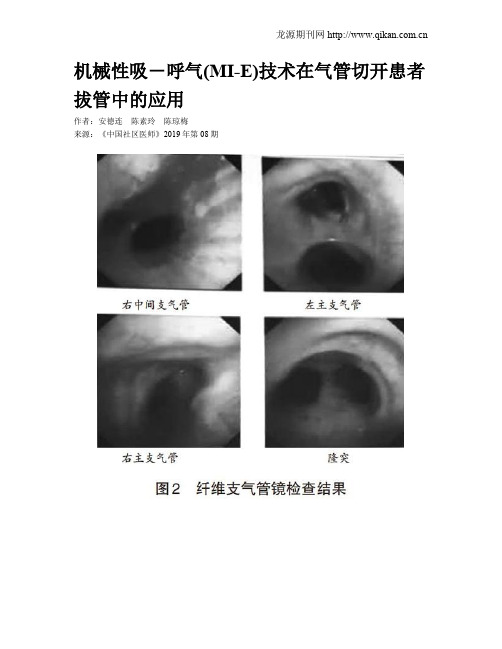 机械性吸-呼气(MI-E)技术在气管切开患者拔管中的应用