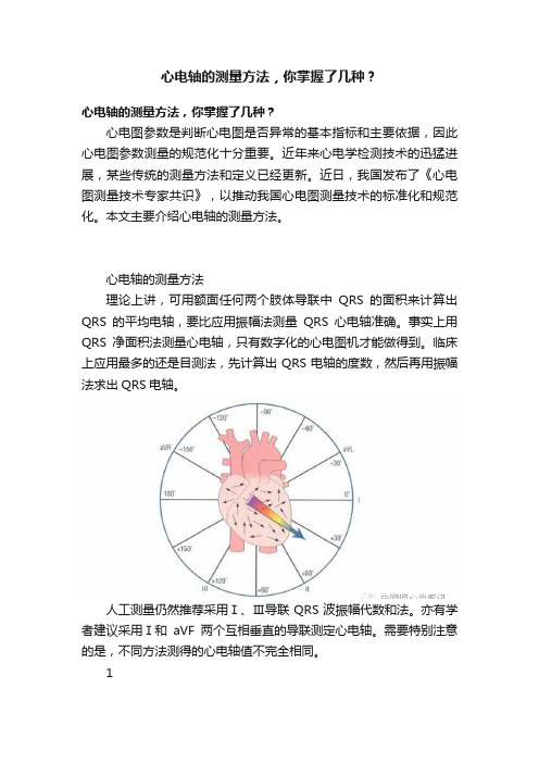 心电轴的测量方法，你掌握了几种？