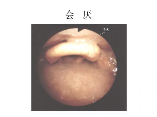 纤支镜的临床图谱