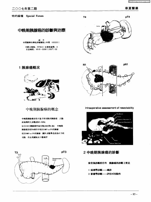 中晚期胰腺癌的诊断与治疗