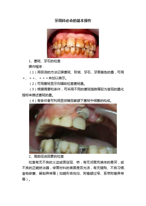 牙周科必会的基本操作