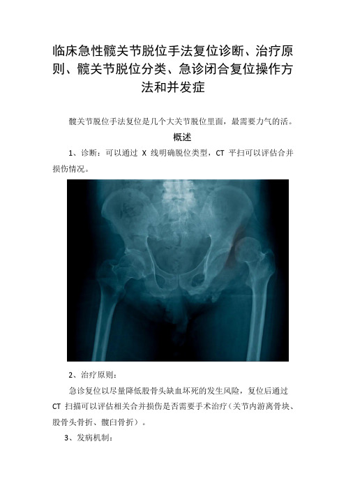 临床急性髋关节脱位手法复位诊断、治疗原则、髋关节脱位分类、急诊闭合复位操作方法和并发症