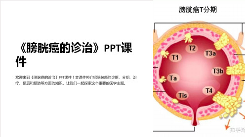 《膀胱癌的诊治》课件