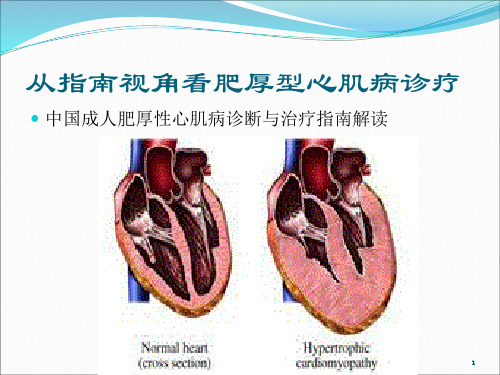 成人肥厚型心肌病诊断与治疗ppt课件