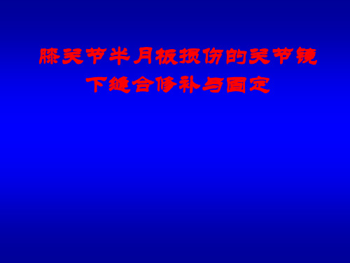 膝关节半月板损伤的关节镜下缝合修补与固定