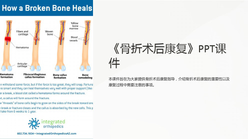 《骨折术后康复》课件