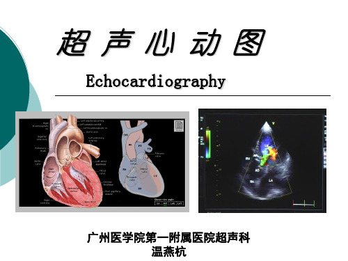 超 声 心 动 图PPT课件