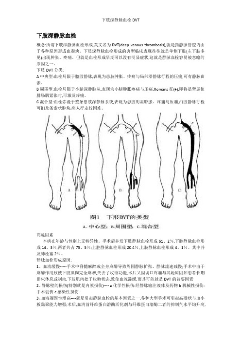 下肢深静脉血栓DVT