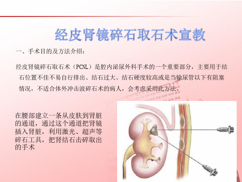 三甲医院《经皮肾镜》课件