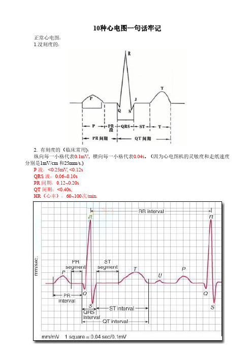 心电图口诀