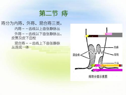 痔课件